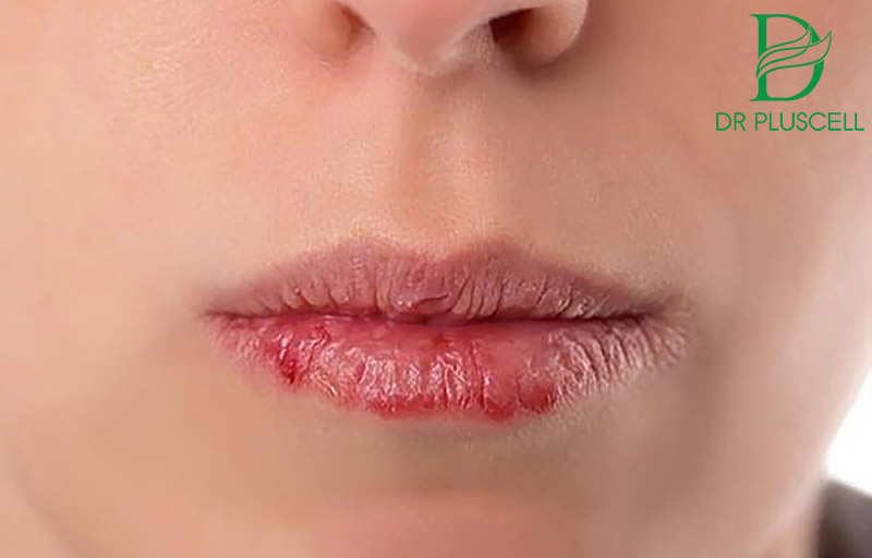dấu hiệu môi bị hỏng sau xăm